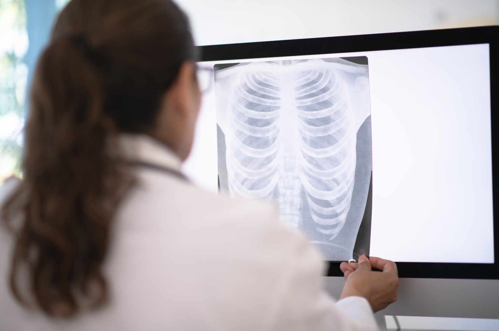 A doctor reviews a patient’s X-ray for a lung cancer diagnosis. (Getty Images Photo)