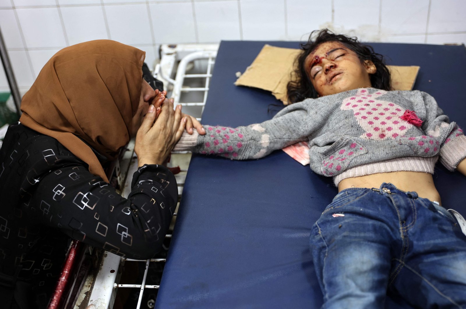 A Palestinian woman comforts a child wounded in an Israeli strike that targeted areas in the northern Gaza Strip, Palestine, Oct. 31, 2024. (AFP Photo)