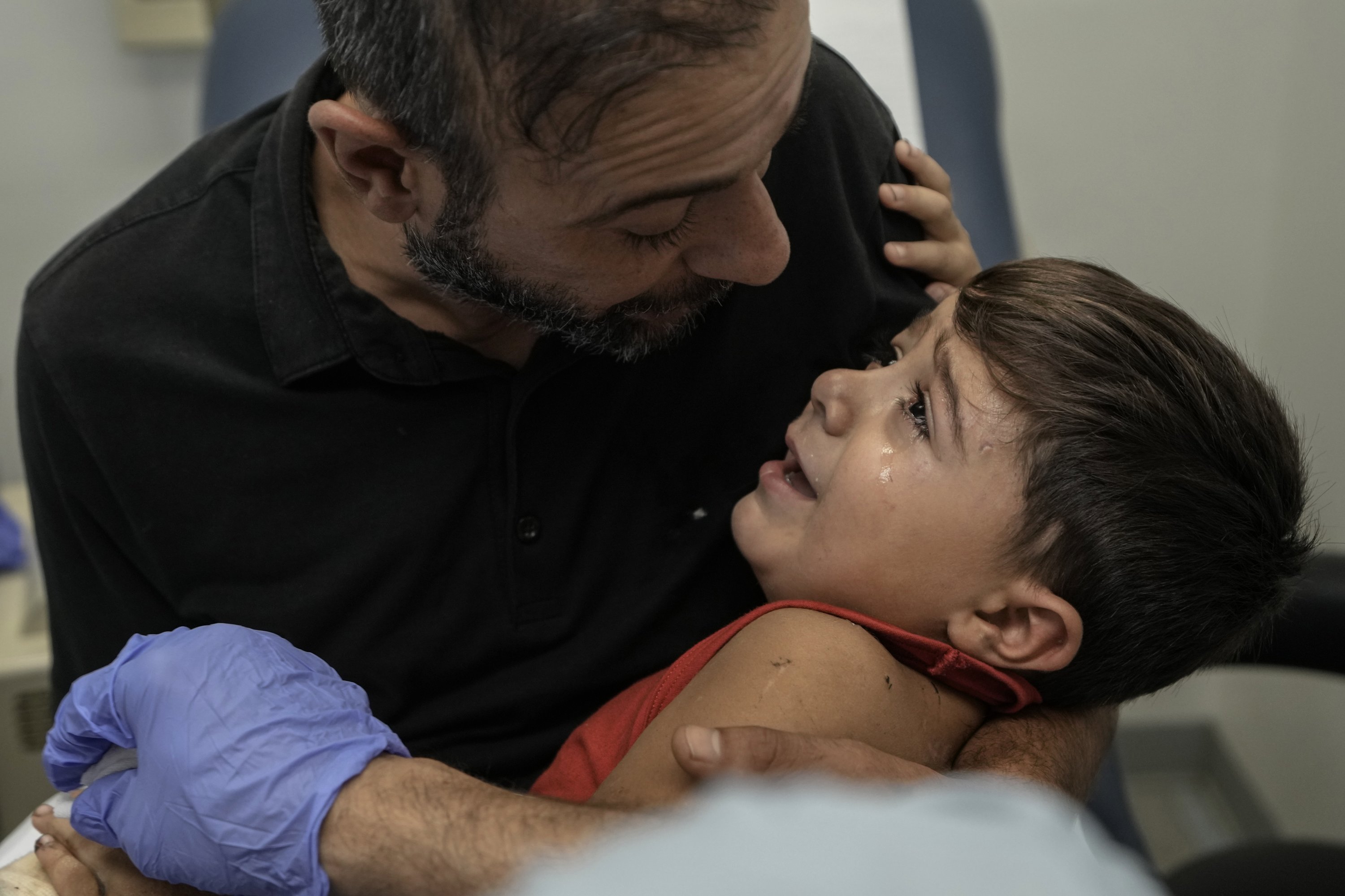 Hassan Mikdad, holds his son Hussein Mikdad, 4, who was injured on Oct. 2 in an Israeli airstrike on south of Beirut, Lebanon, Nov. 5, 2024. (AP Photo)