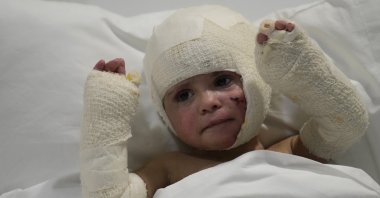Ivana Skakye, 2, a Lebanese child who is suffering from third-degree burns over 40% of her body following an Israeli airstrike lies on a bed at the Geitaoui hospital, Beirut, Lebanon, Oct. 29, 2024. (AP Photo)