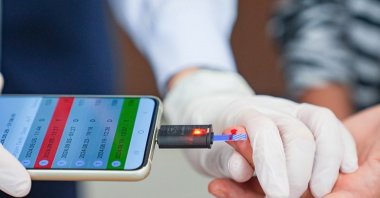 The device connects to a smartphone to allow real-time blood sugar monitoring, Izmir, Türkiye, Nov. 18, 2024. (AA Photo)