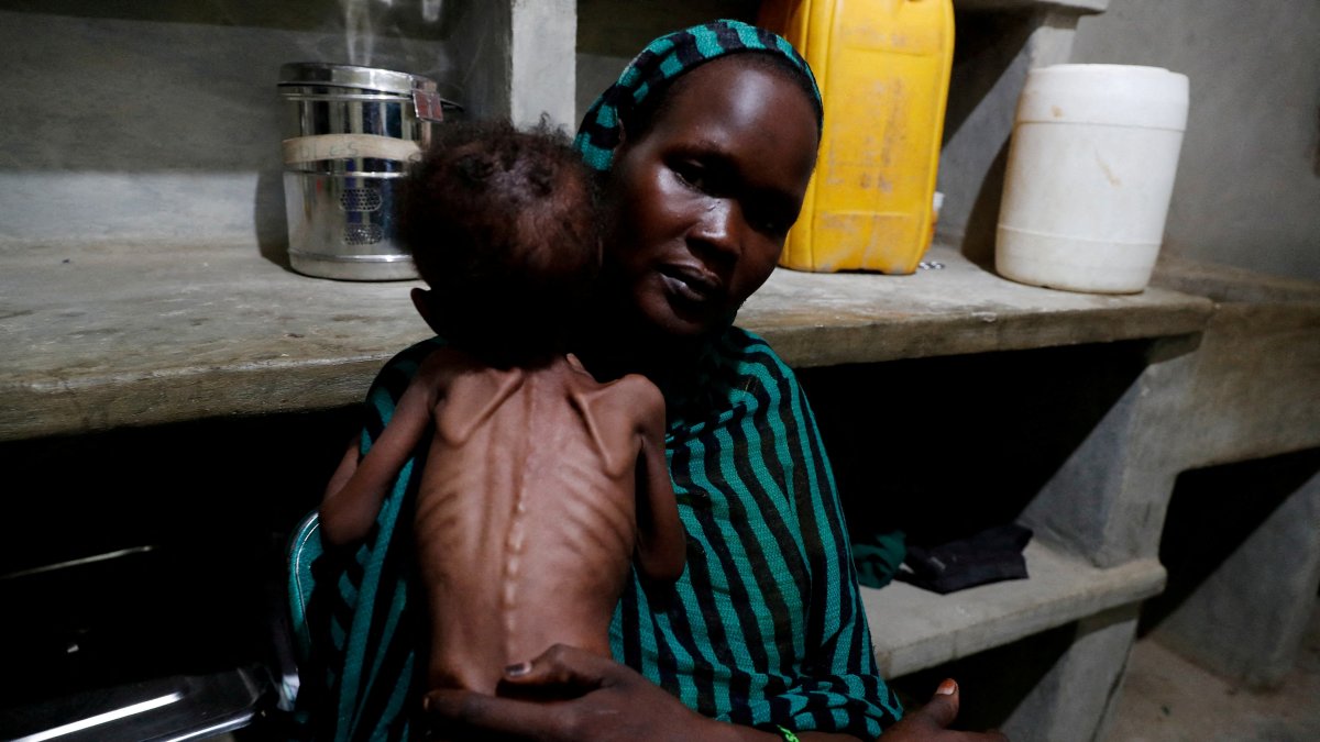 Robaika Peter, 25, holds her severely malnourished child at the pediatric ward of the Mother of Mercy Hospital in Gidel, South Kordofan, Sudan, June 25, 2024. (Reuters Photo)