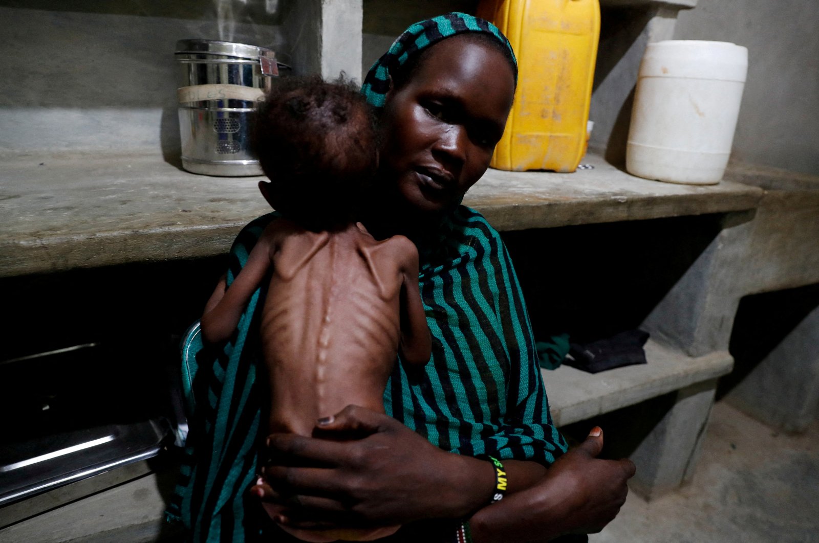 Robaika Peter, 25, holds her severely malnourished child at the pediatric ward of the Mother of Mercy Hospital in Gidel, South Kordofan, Sudan, June 25, 2024. (Reuters Photo)