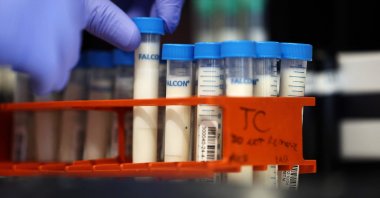 A lab manager in the molecular diagnostic lab prepares milk samples for testing at the Animal Health Diagnostic Center at Cornell University in Ithaca, New York, U.S., Dec. 10, 2024. (AFP Photo)