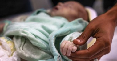 A Palestinian man holds the hand his niece 3-week old Sila al-Faseeh, who reportedly died of hypothermia, at the morgue of the Nasser Hospital in Khan Yunis, southern Gaza, Palestine, Dec. 25, 2024. (AFP Photo)