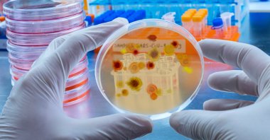 People will be sent from Britain to the Netherlands to be intentionally infected with a type of malaria for scientific research on its effects. (Shutterstock Photo)