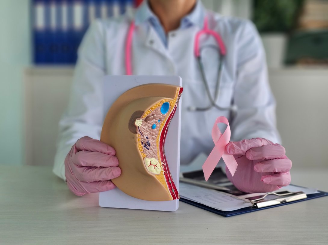 Breast cancer awareness in Türkiye is growing through joint efforts from foundations and businesses. (Shutterstock Photo)