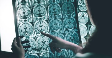 Chinese scientists have revealed the intrinsic link between the topological structure of human brain cortex connections and genetic characteristics. (AP Photo)