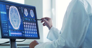 Applied in over 2,500 open brain surgeries, the technique has demonstrated its effectiveness in preventing cerebrospinal fluid leakage. (Shutterstock Photo)