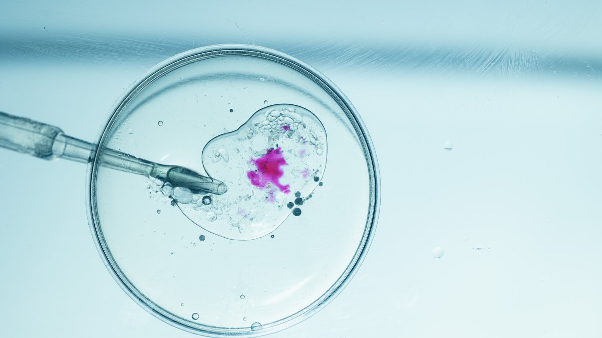 A woman in Australia unknowingly gave birth to a stranger’s baby after she received another patient&#039;s embryo from her in vitro fertilization clinic due to &quot;human error,” the clinic said. (Shutterstock Photo)
