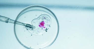 A woman in Australia unknowingly gave birth to a stranger’s baby after she received another patient&#039;s embryo from her in vitro fertilization clinic due to &quot;human error,” the clinic said. (Shutterstock Photo)