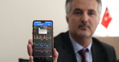 Assoc. Prof. Dr. Haydar Ankışhan presents the AI-supported lung cancer detection application at Ankara University, Ankara, Türkiye, April 28, 2025. (AA Photo) 