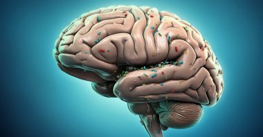 In the brain&#039;s frontal lobe alone, researchers discovered approximately 4,917 micrograms of plastic per gram of tissue, up from 3,345 micrograms in 2016. (Shutterstock Photo)