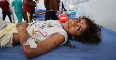 A girl wounded in an Israeli strike receives treatment at al-Awda Hospital, Nuseirat refugee camp, central Gaza Strip, Palestine, May 19, 2025. (AFP Photo)