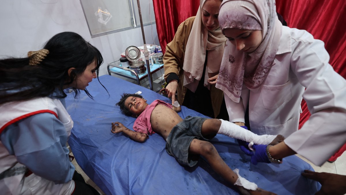 An injured child receives medical care at the Al-Awda Hospital in the Nuseirat refugee camp in the central Gaza Strip, following an Israeli strike, May 29, 2025. (AFP Photo)