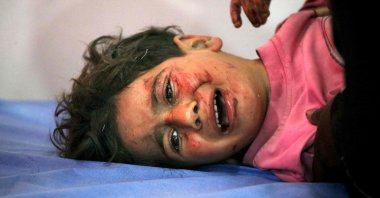 An injured child cries while receiving medical care at the al-Awda Hospital in the Nuseirat refugee camp, central Gaza Strip, Palestine, May 29, 2025. (AFP Photo)