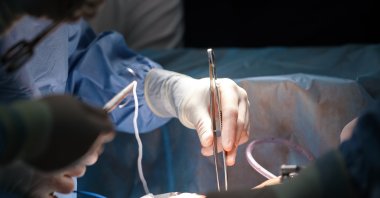 Despite a growing number of organ donations, Türkiye still performs only 40 to 45 heart transplants annually. (Shutterstock Photo)