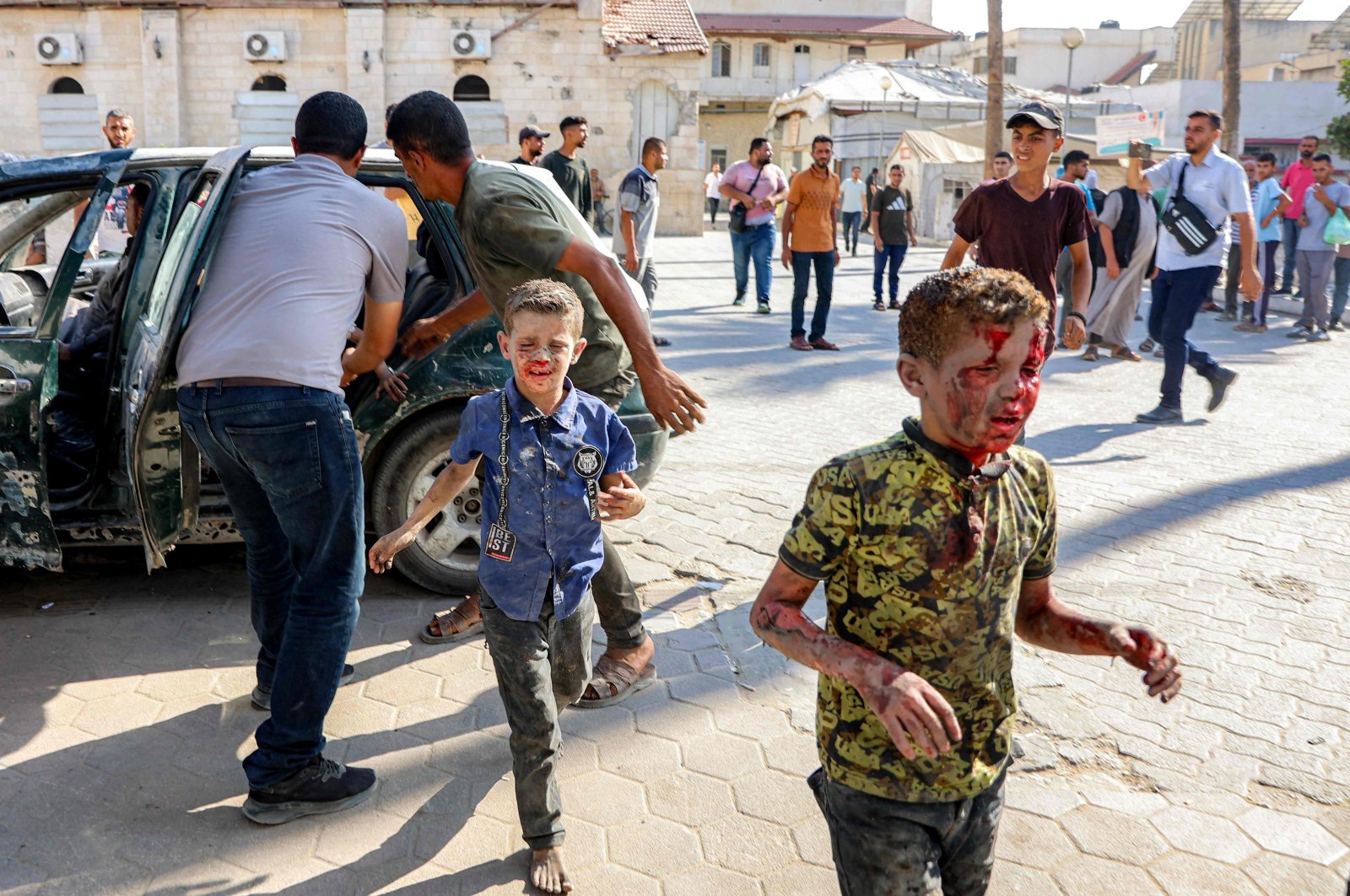 Injured Palestinian children react as they arrive at a hospital following an Israeli strike in Gaza City, in the central Gaza Strip, Palestine, July 2, 2025. (AFP Photo)