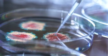 A large-scale study tracing 37,000 years of disease has identified harmful pathogens and the earliest known plague bacterium from 5,500 years ago. (Getty Images Photo)