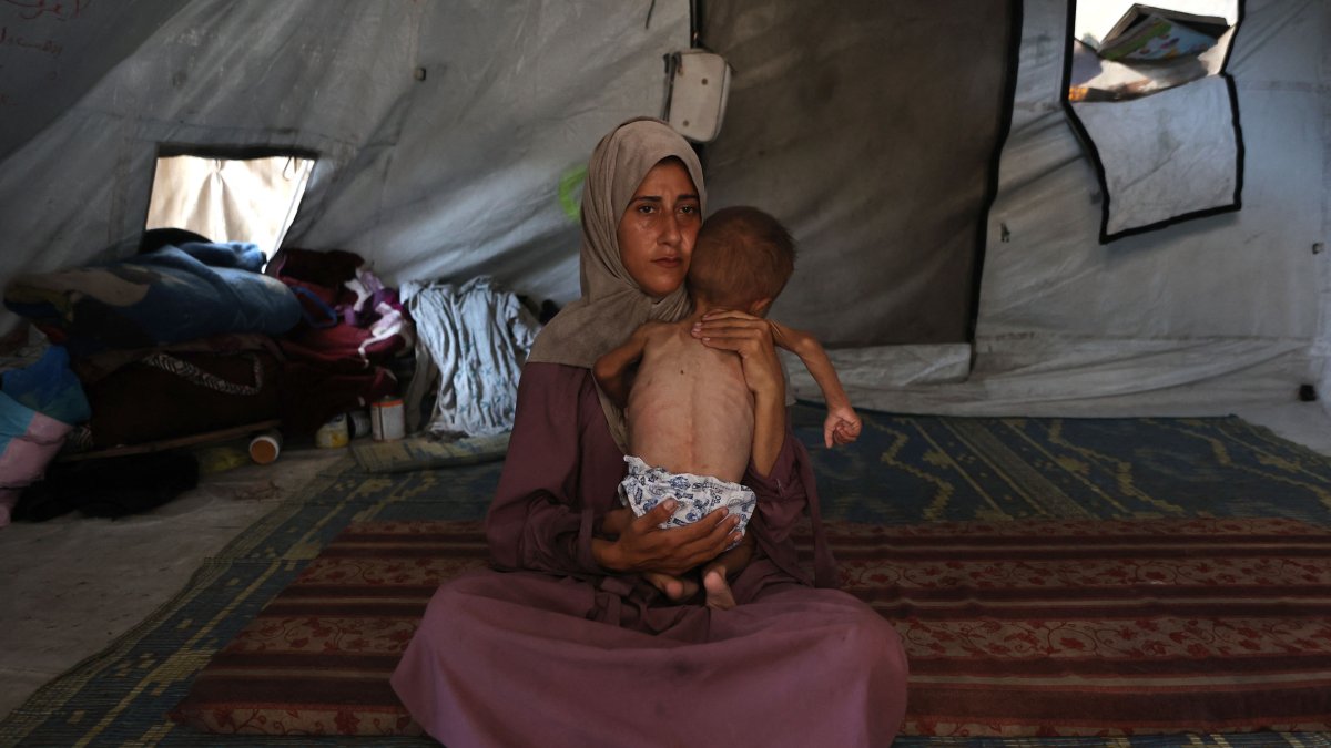 Hidaya, a 31-year-old Palestinian mother, cradles her sick 18-month-old son Mohammed al-Mutawaq, who is also displaying signs of malnutrition, inside their tent at the Al-Shati refugee camp, west of Gaza City, July 24, 2025. (AFP Photo)