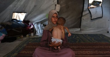 Hidaya, a 31-year-old Palestinian mother, cradles her sick 18-month-old son Mohammed al-Mutawaq, who is also displaying signs of malnutrition, inside their tent at the Al-Shati refugee camp, west of Gaza City, July 24, 2025. (AFP Photo)