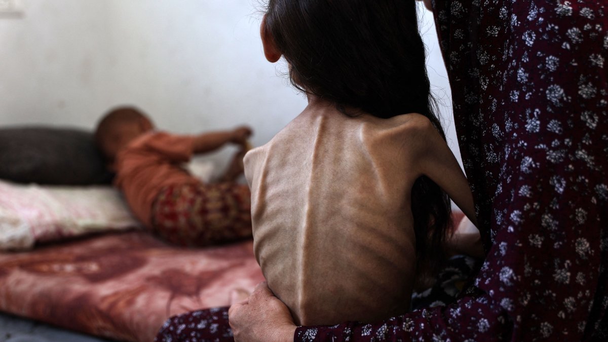 A malnourished Palestinian girl Mariam Dawwas, 9, who weighed 25 kilograms before the war and now dropped to 10 kilograms, sits on the floor with her mother, Rimal neighbourhood, Gaza City, Palestine, Aug. 2, 2025. (AFP Photo)