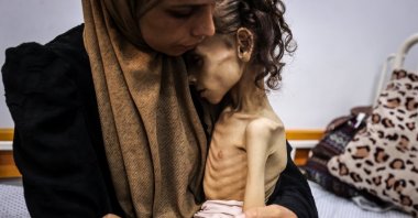 Nine-year-old Maryam Duvvas, who is being treated at a hospital, is in critical condition due to severe malnutrition, Gaza, Palestine, Aug. 4, 2025. (AA Photo)