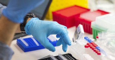 A lab technician prepares DNA samples for analysis at Complete Genomics in San Jose, Calif., Monday, July 22, 2024. (AP File Photo)