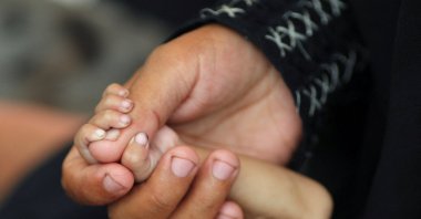 Palestinian mother holds the hand of her baby, whom she says is wasting away from malnutrition, Gaza City, Palestine, Aug. 5, 2025. (Reuters Photo)