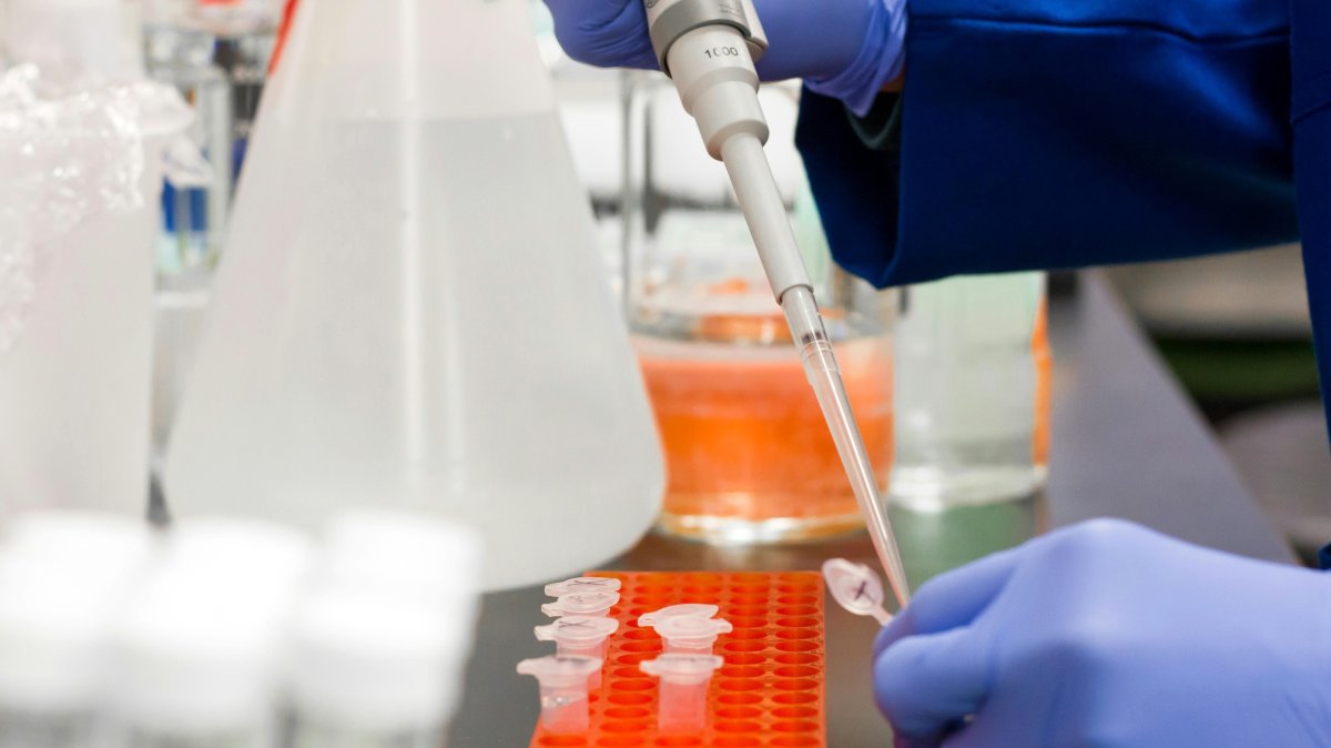 Turkish universities develop early detection kit for hepatitis D