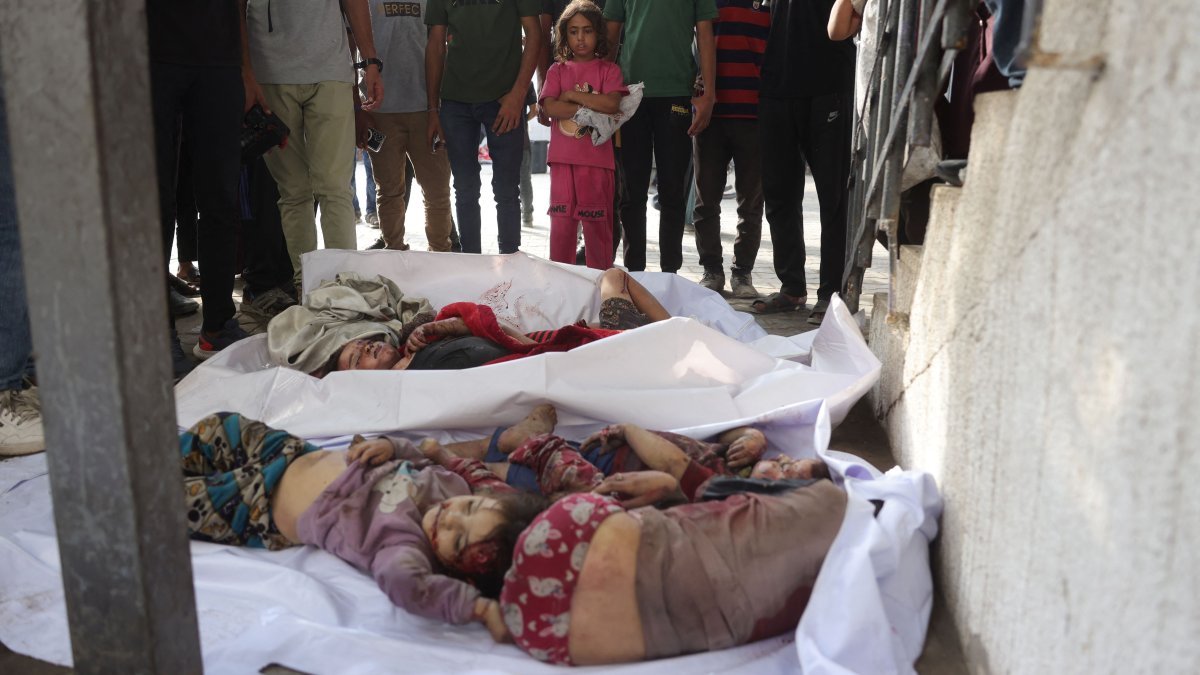Palestinians stand over the bodies of children from the Irhim family, killed in an early morning Israeli strike on the Zaitoun district, at Gaza City&#039;s Al-Shifa hospital, Aug.11, 2025. (AFP Photo)