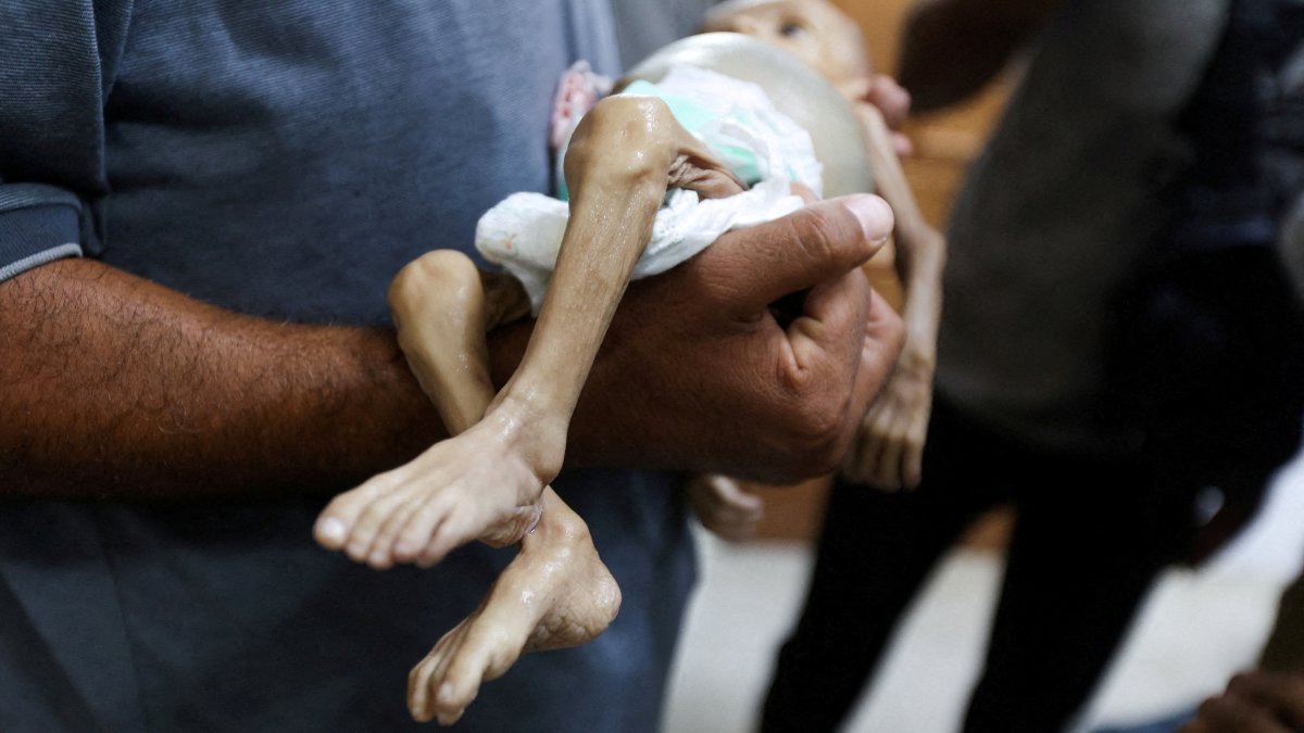 A man carries the body of Palestinian baby Zainab Abu Haleeb, who died due to malnutrition, at Nasser Hospital in Khan Younis, southern Gaza Strip, July 26, 2025. (Reuters Photo)