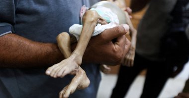 A man carries the body of Palestinian baby Zainab Abu Haleeb, who died due to malnutrition, at Nasser Hospital in Khan Younis, southern Gaza Strip, July 26, 2025. (Reuters Photo)