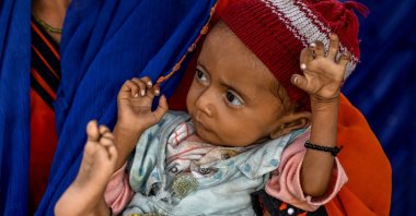 This photograph shows a child in her mother&#039;s arms during a UNICEF nutrition programme at Fateh Muhammad Soomro village in the Sujawal district of Sindh province, Pakistan, July 29, 2025. (AFP Photo)