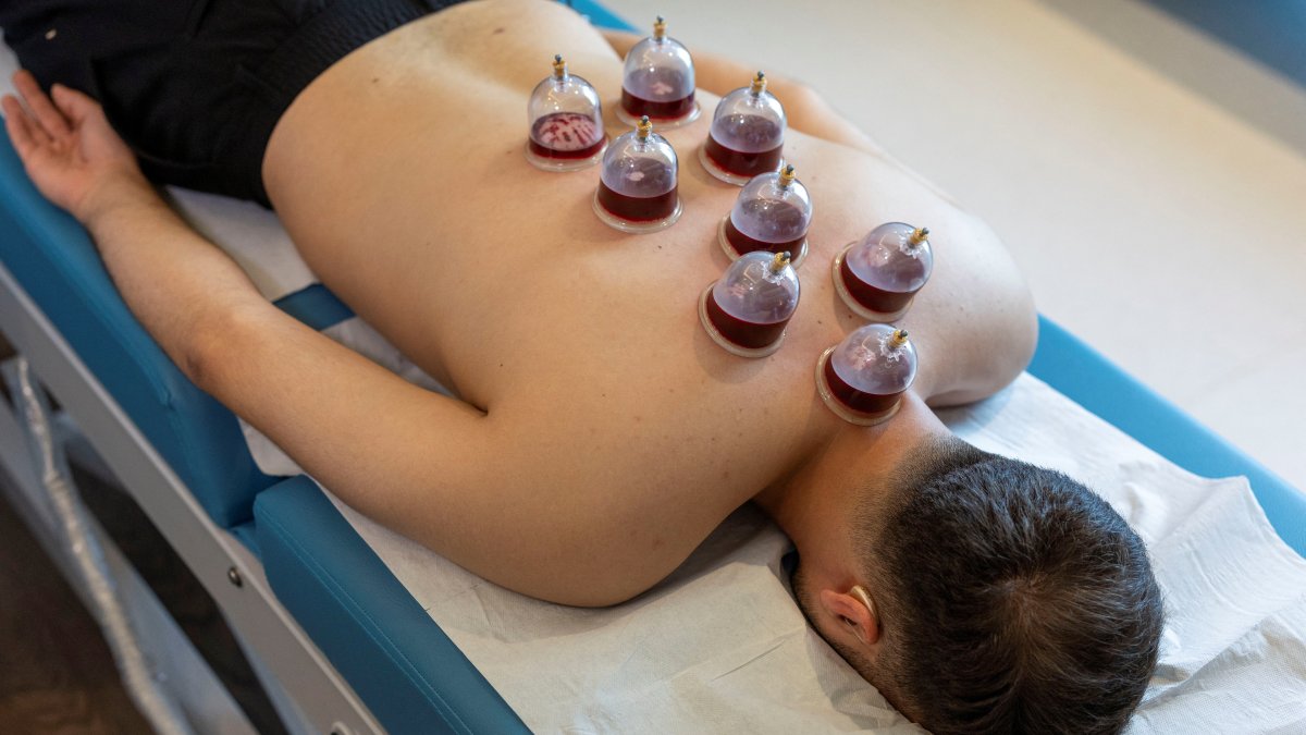 Furkan Ali Sayan waits for his cupping therapy to end at Medicana International Hospital, Istanbul, Türkiye, Aug. 28, 2025. (Reuters Photo)