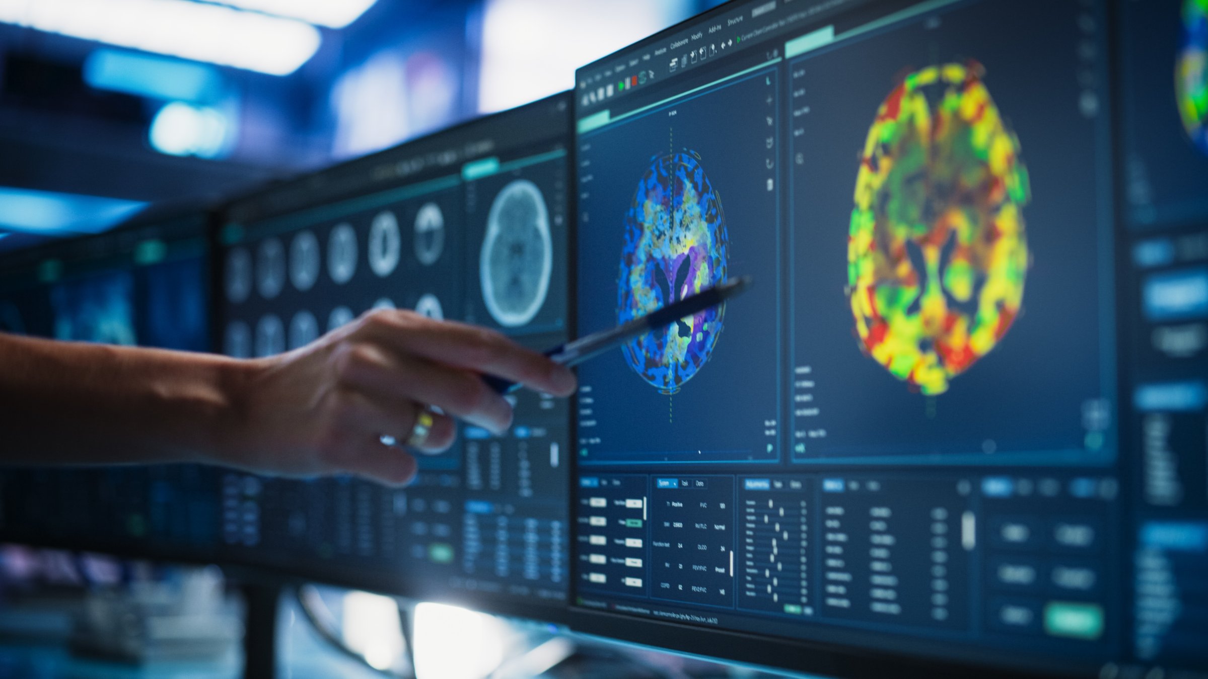 A doctor examines a CT scan of a patient’s spinal cord at a medical research center, searching for tumors or damage and exploring treatment options. (Shutterstock Photo) 