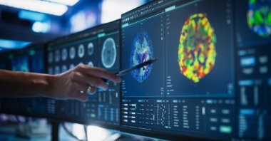 A doctor examines a CT scan of a patient’s spinal cord at a medical research center, searching for tumors or damage and exploring treatment options. (Shutterstock Photo) 