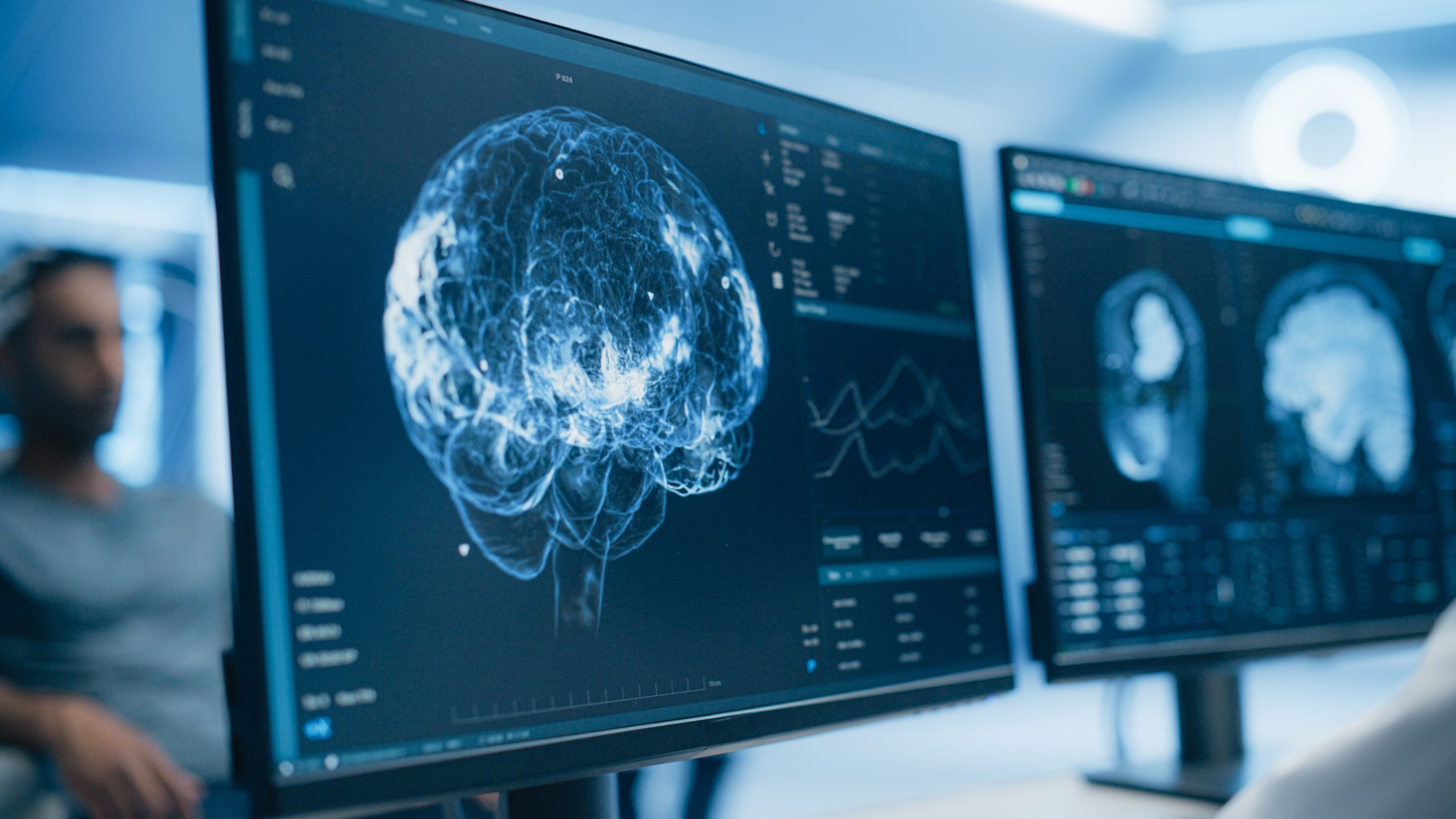 Advanced neuroimaging displays multiple brain scans on computer screens, revealing complex neural pathways. (Shutterstock Photo) 