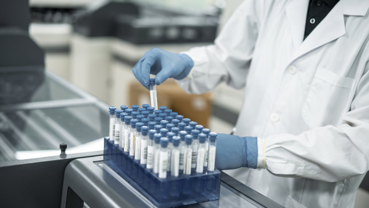 A hand is operates a test tube experiment in a laboratory (Getty Images)