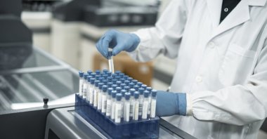 A hand is operates a test tube experiment in a laboratory (Getty Images)