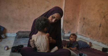 Naima Abu Ful poses for a photo with her 2-year-old malnourished child, Yazan, at their home in the Shati refugee camp, Gaza City, Palestine, July 23, 2025. (AP Photo)
