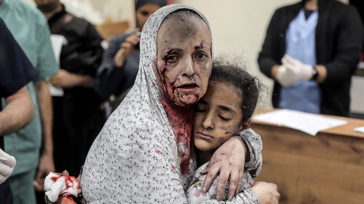 An injured Palestinian woman covered in dust and blood hugs an injured girl child at the hospital following the Israeli bombardment of Khan Younis in the southern Gaza Strip, Nov. 15, 2023. (AFP File Photo)