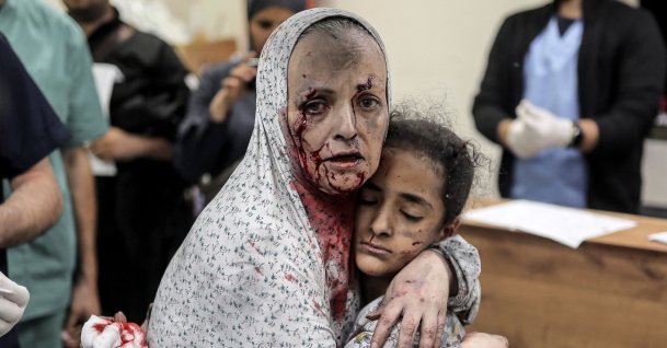 An injured Palestinian woman covered in dust and blood hugs an injured girl child at the hospital following the Israeli bombardment of Khan Younis in the southern Gaza Strip, Nov. 15, 2023. (AFP File Photo)