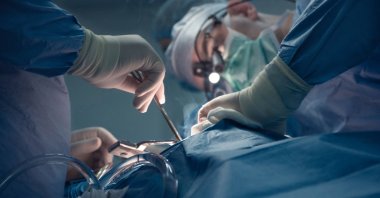 Doctors perform a complex organ transplant procedure under sterile conditions. (Shutterstock Photo)