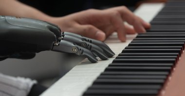 A man demonstrates a prosthetic hand playing the piano at the Shanghai New Expo Center during the World Artificial Intelligence Conference 2025, Shanghai, China, July 27, 2025. (Getty Images Photo)