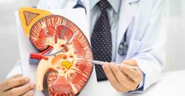 A doctor examines a human kidney model to study and treat chronic kidney disease. (Shutterstock Photo) 