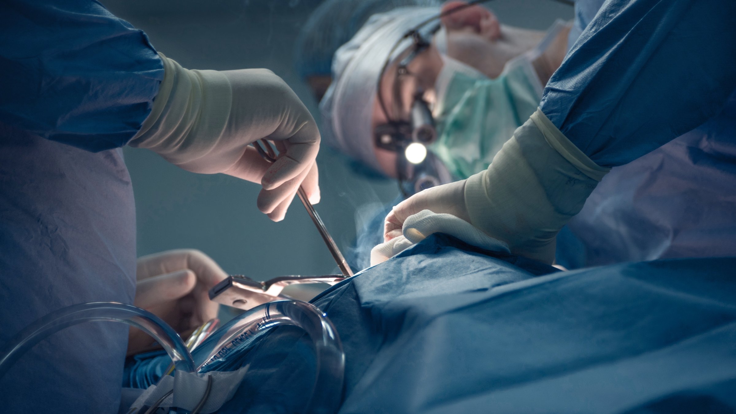 Surgeons perform a heart transplant operation at a hospital. (Shutterstock Photo)