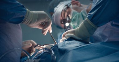 Surgeons perform a heart transplant operation at a hospital. (Shutterstock Photo)
