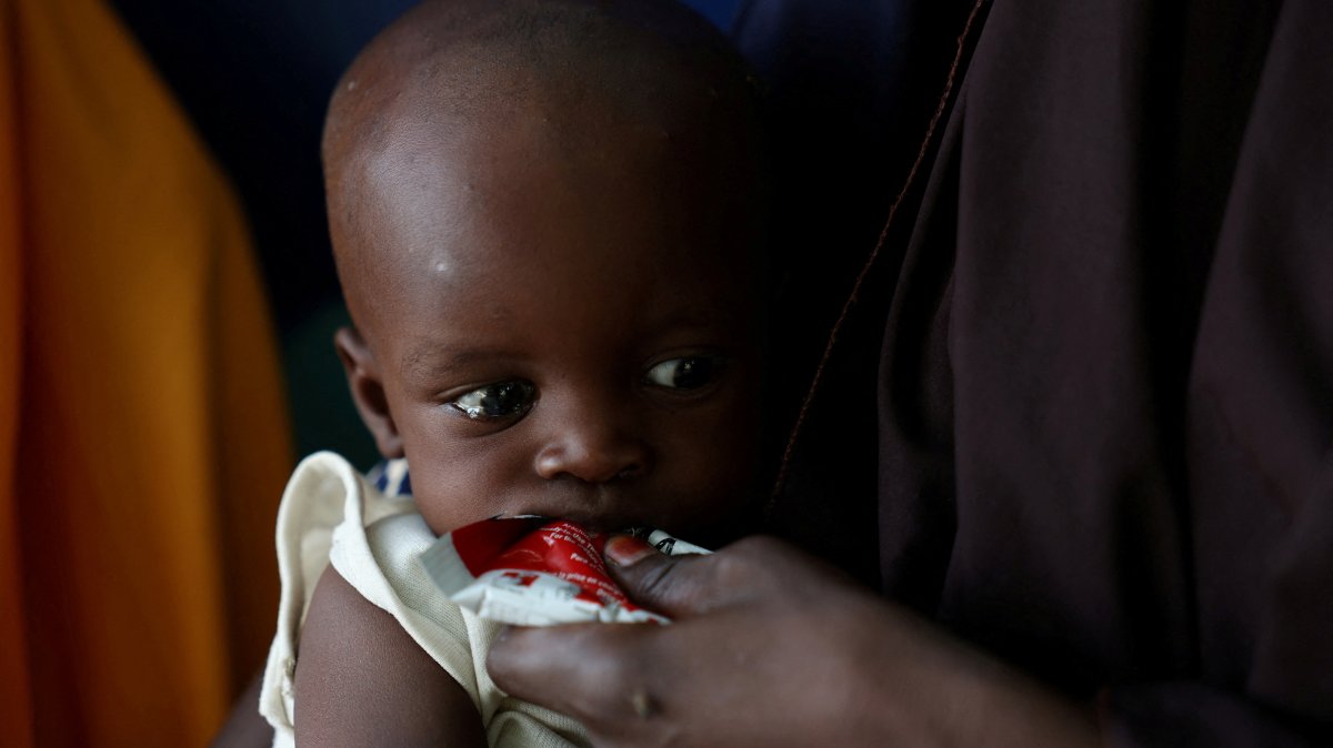 A malnourished child is fed with Ready-to-use Supplementary Food (RUSF) by her mother, in Dikwa, Borno State, Nigeria, Aug. 27, 2025. (Reuters Photo)