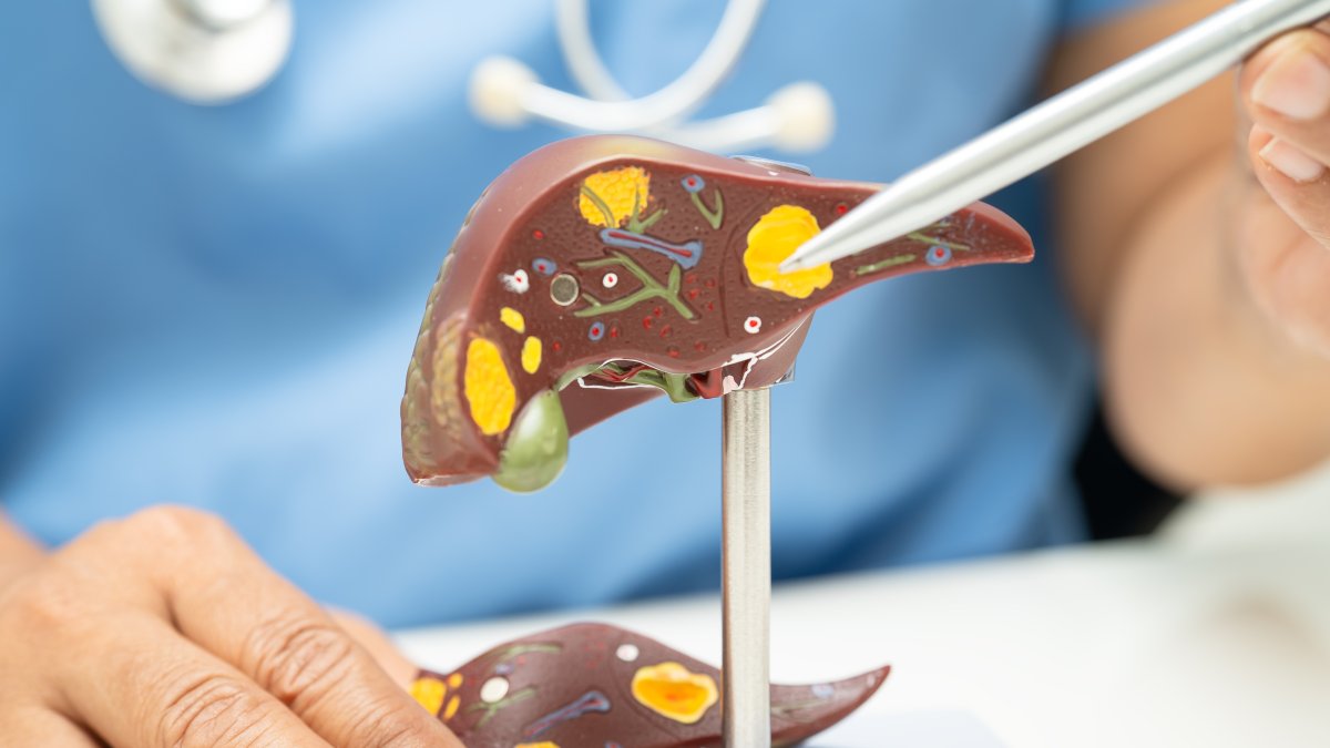 A doctor shows the liver anatomy model while explaining fatty liver. (Shutterstock Photo) 